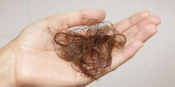 Rambut Rontok Gejala Diabetes