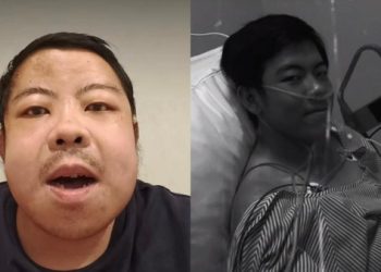Warga Jakarta ini Cuci Darah Sejak Usia 16 Tahun Hingga Kini 32 Tahun